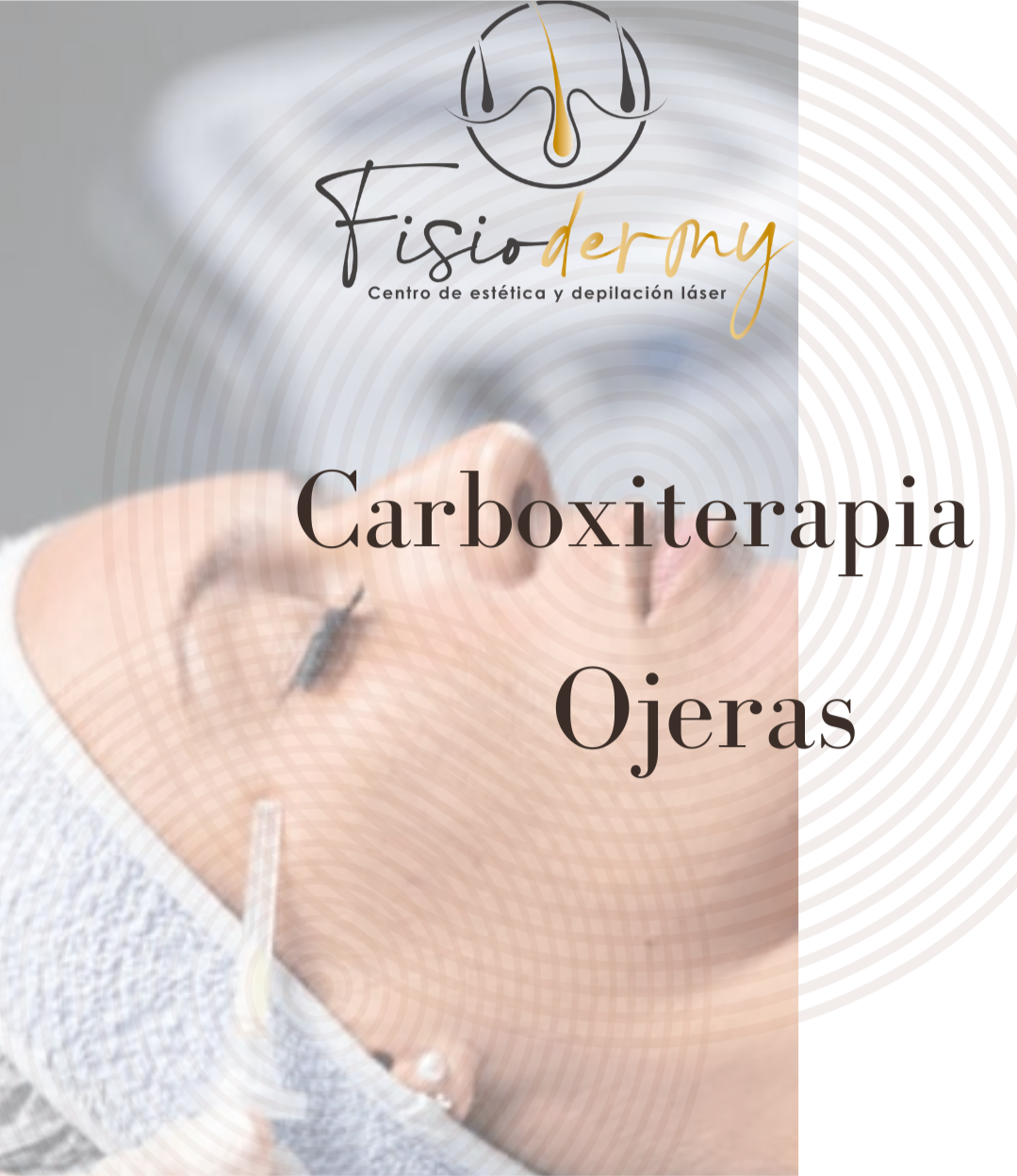 Carboxiterapia Ares Ojeras