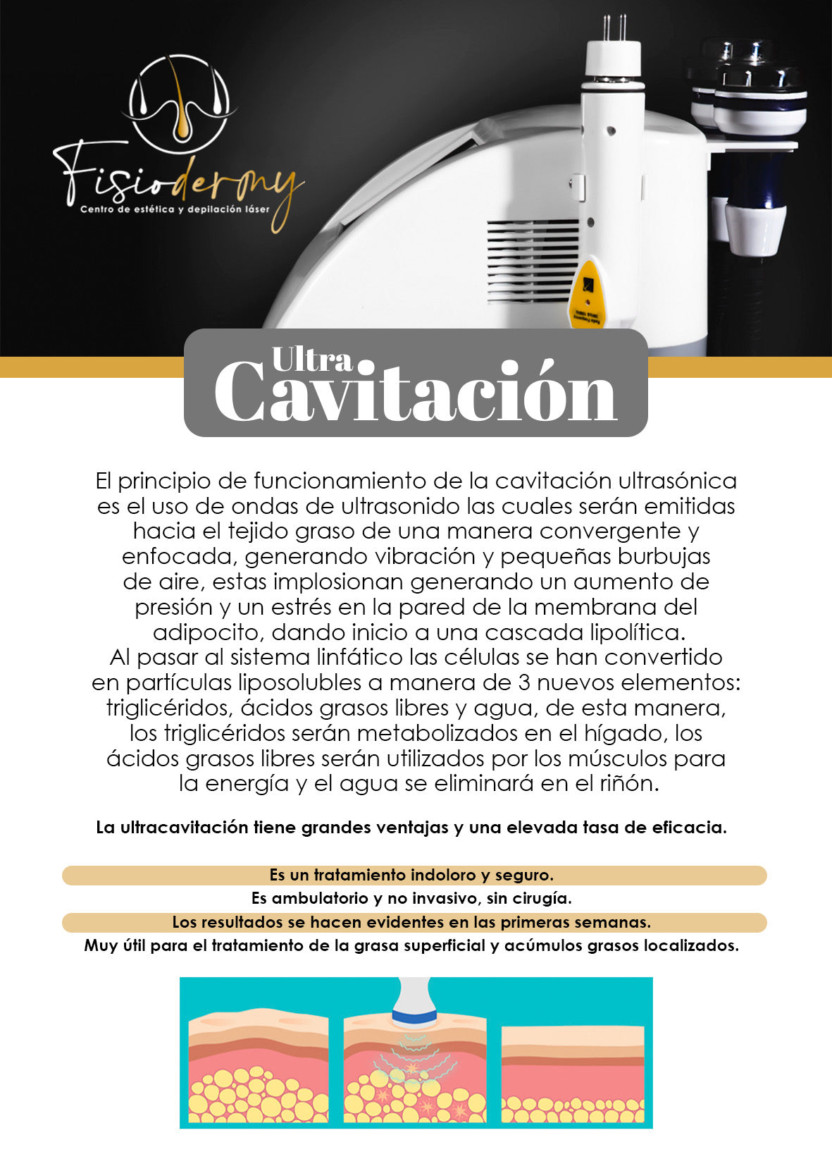 Mantención tratamiento corporal