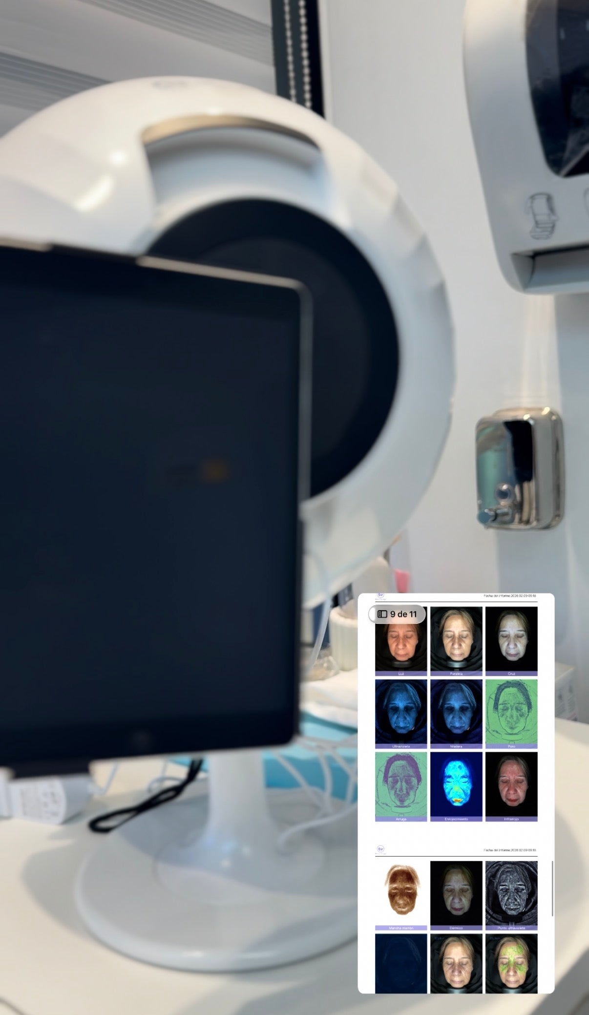 DIAGNÓSTICO DIGITAL FACIAL