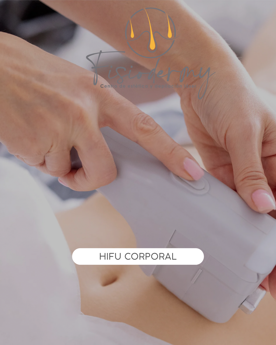 HIFU abdomen más cintura