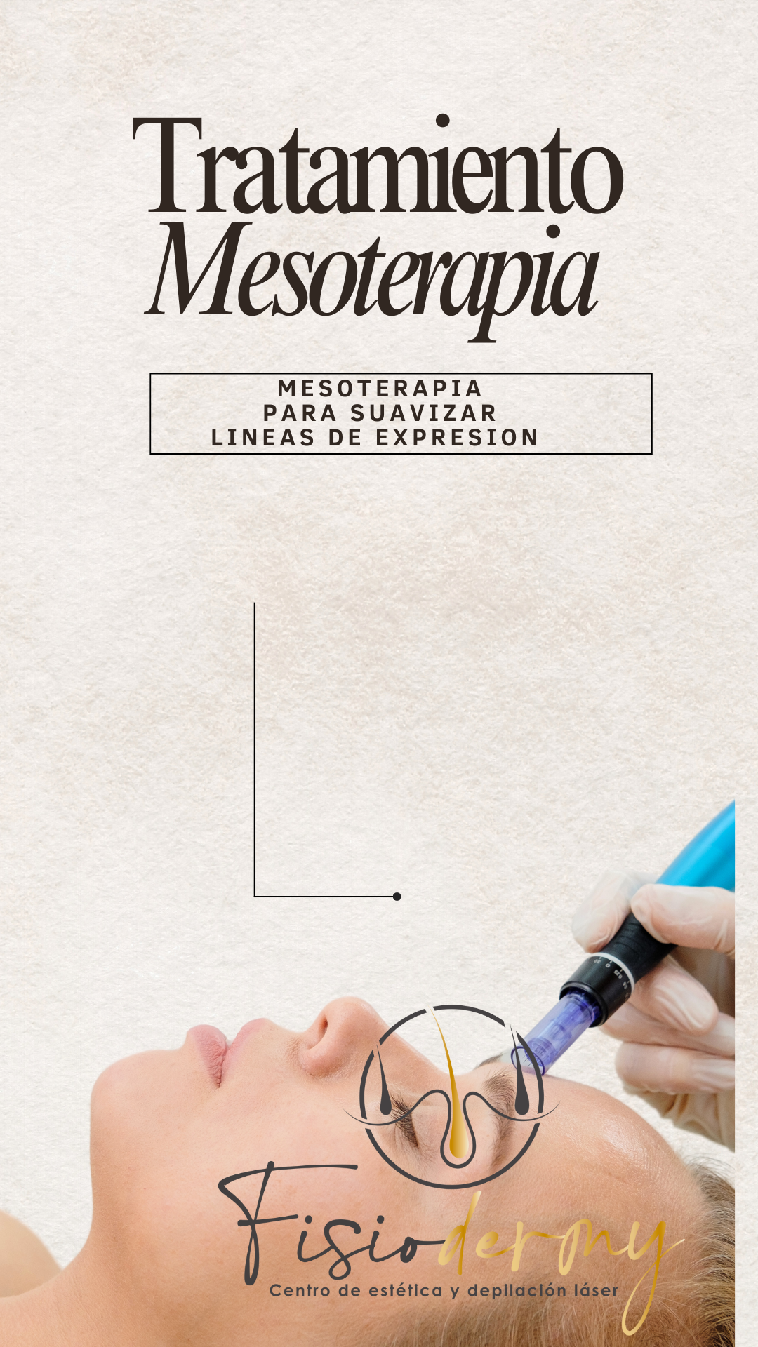 BLACK FRIDAY Pack de 6 sesiones Mesoterapia