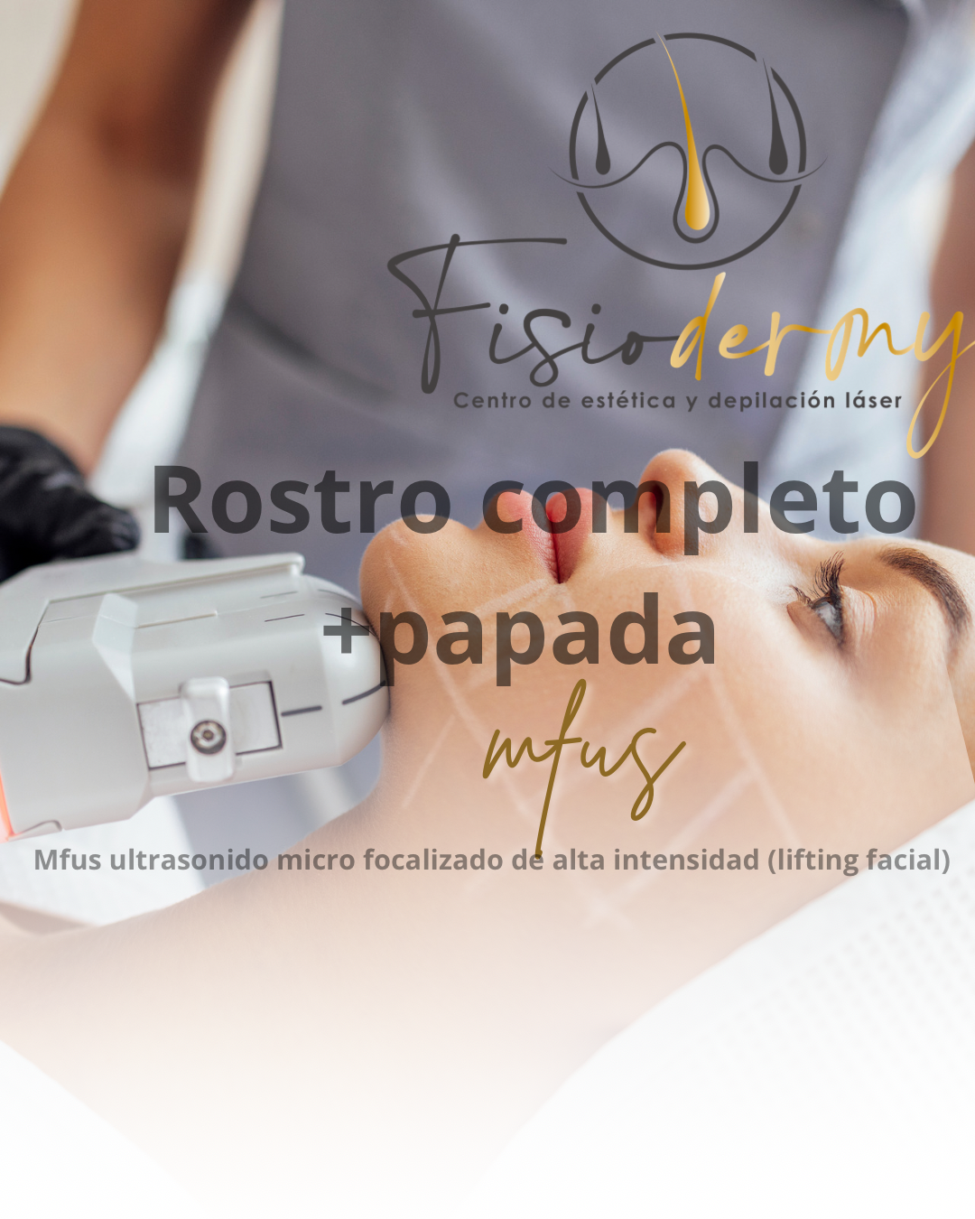 HIFU/MFUS ROSTRO MÁS PAPADA