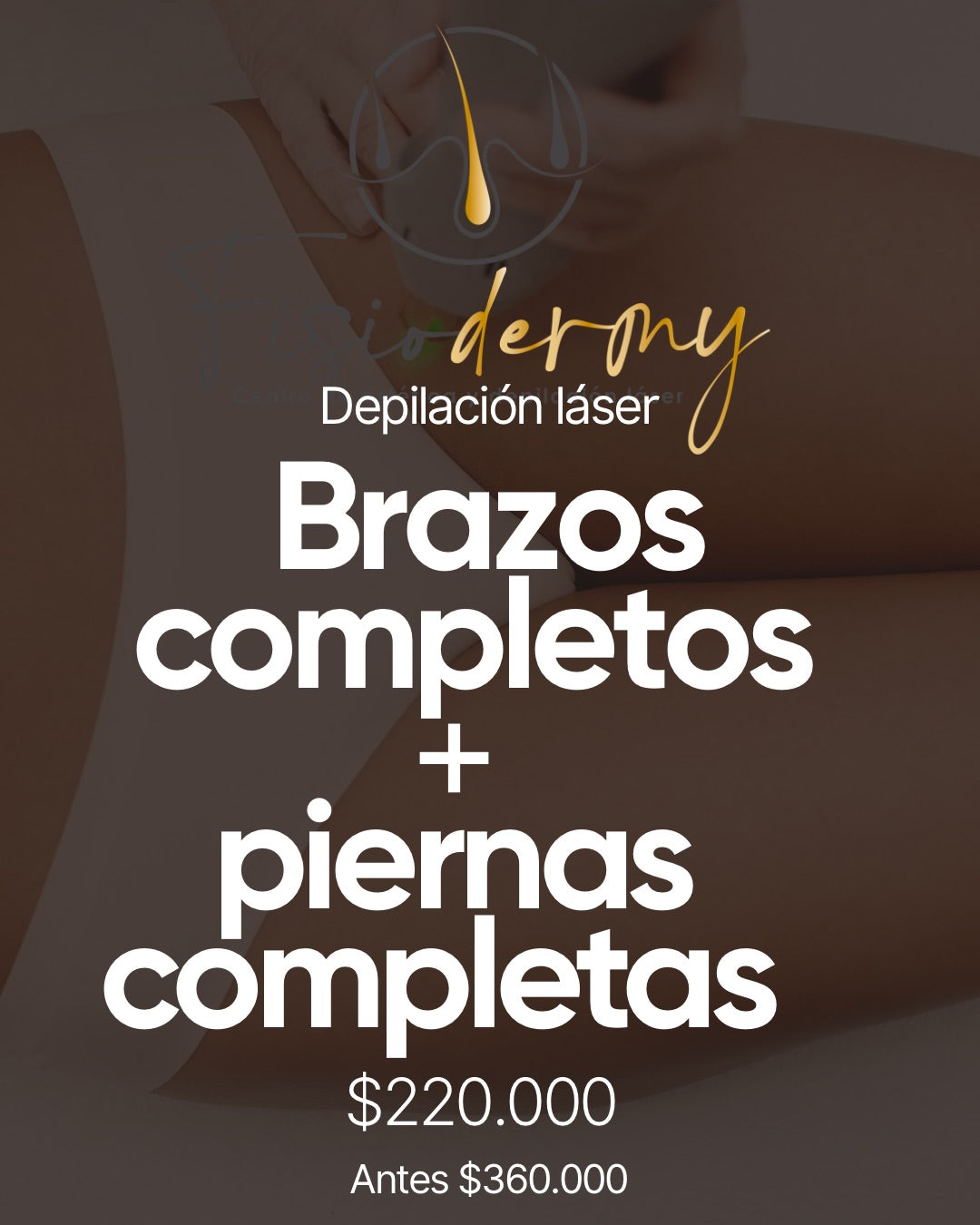 CYBER piernas completas y brazos completos (6 sesiones)