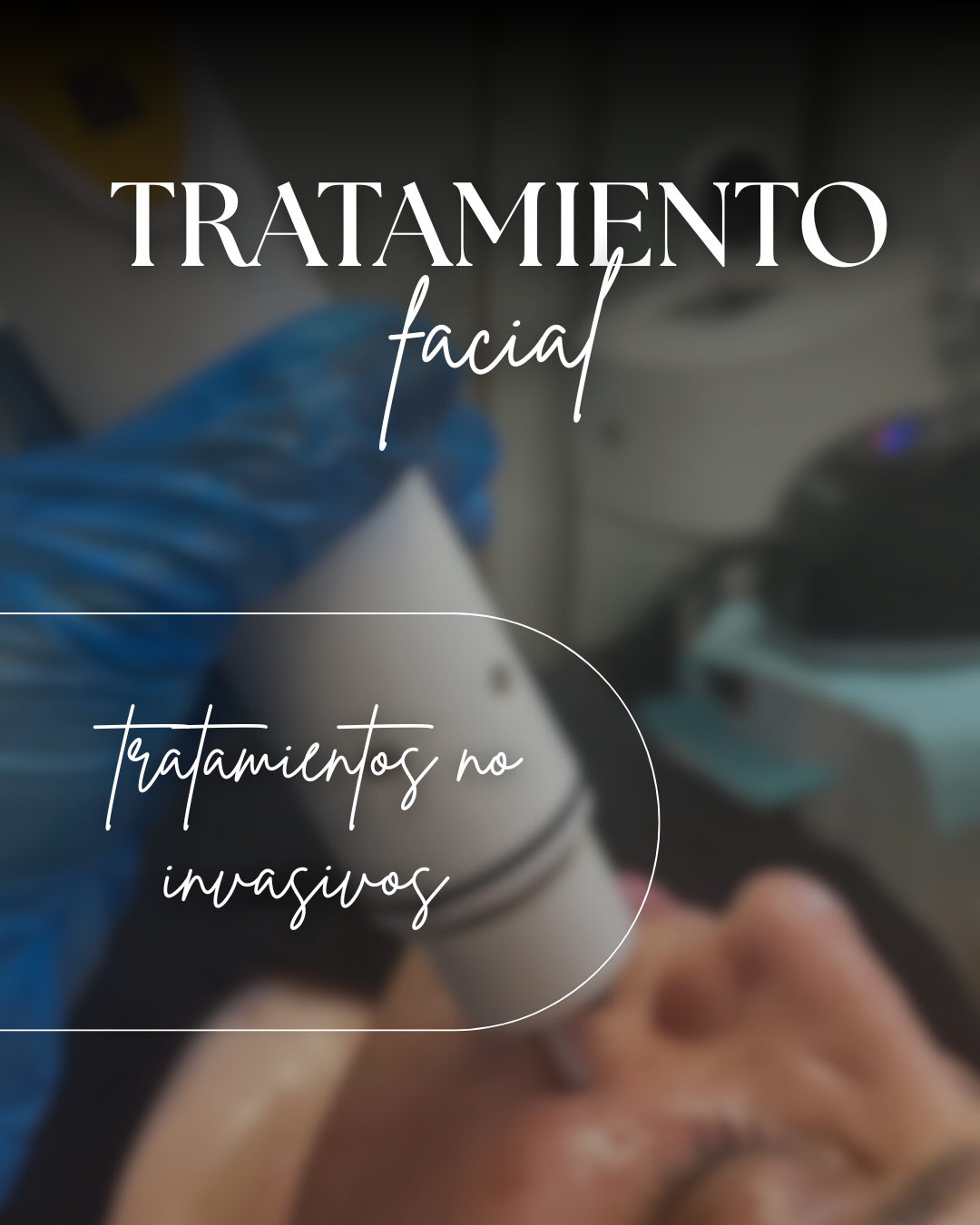 Radiofrecuencia facial luna box 6 sesiones