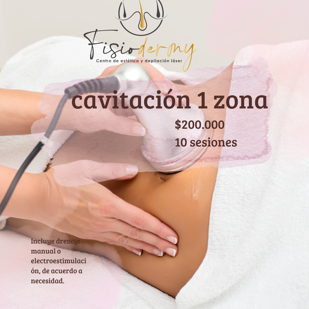 CAVITACION luna box Reductor 1 zona