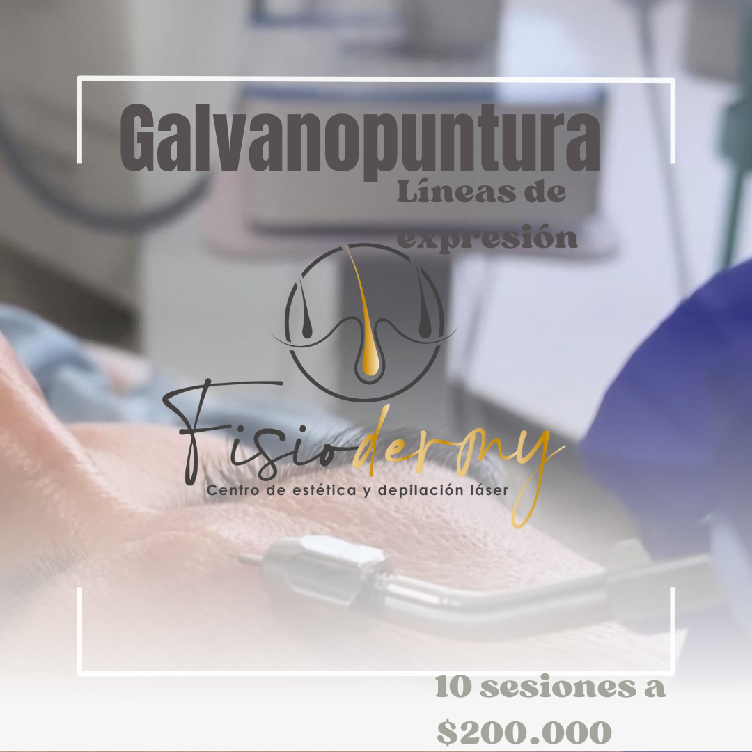 Galvanopuntura líneas de expresión