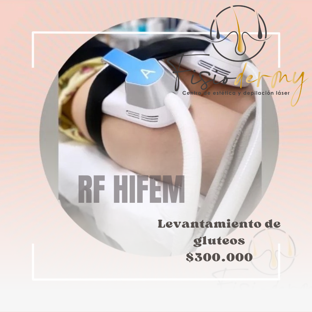 Levantamiento de gluteos