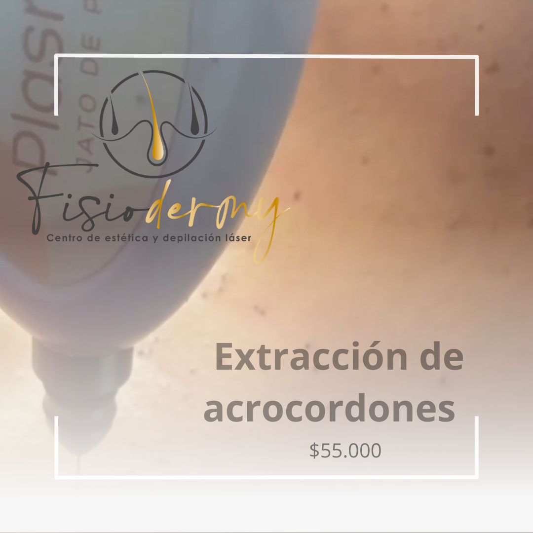 Extracción de acrocordones, millium y quistes epidermicos.