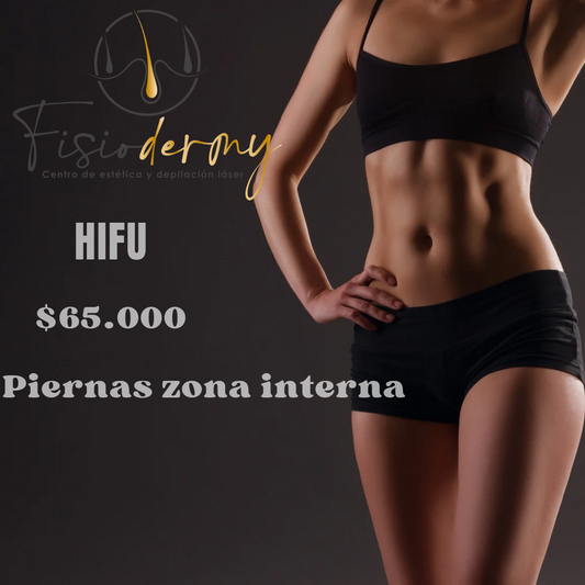 HIFU piernas