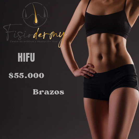 HIFU brazos