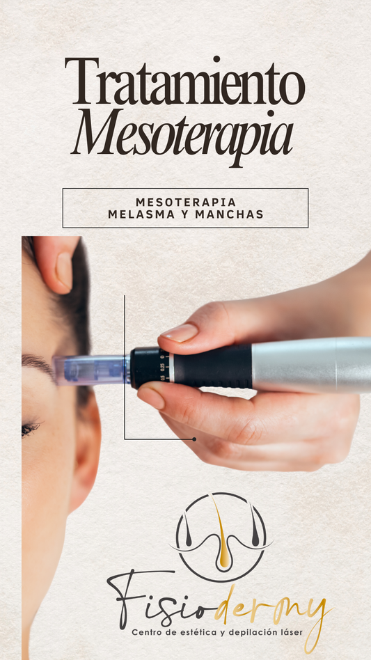 Mesoterapia melasma y mancha 1 sesión F-RADIANCE