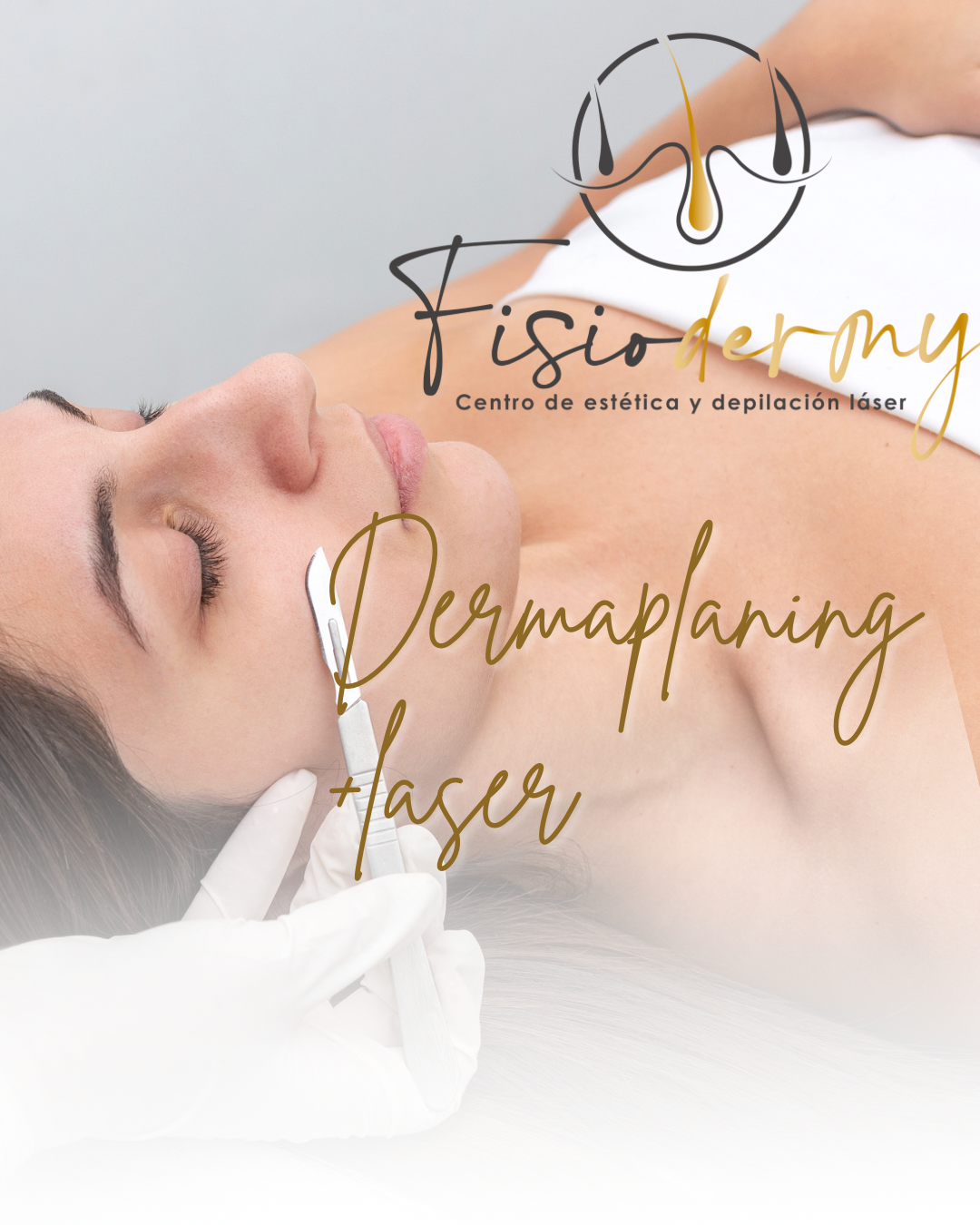 Dermaplaning Rostro + Láser Blend4(zona M) 1 sesión