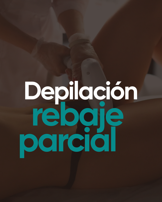 Depilación  láser rebaje parcial (zona S) 6 sesiones