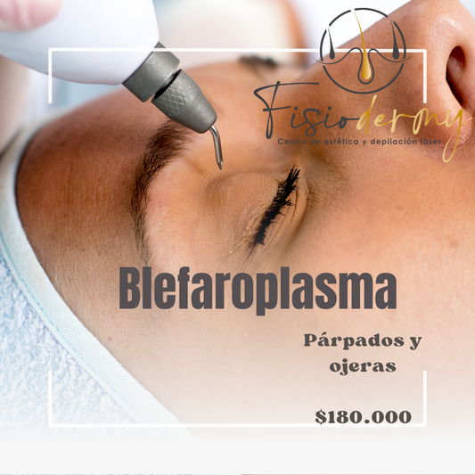 Blefaroplasma